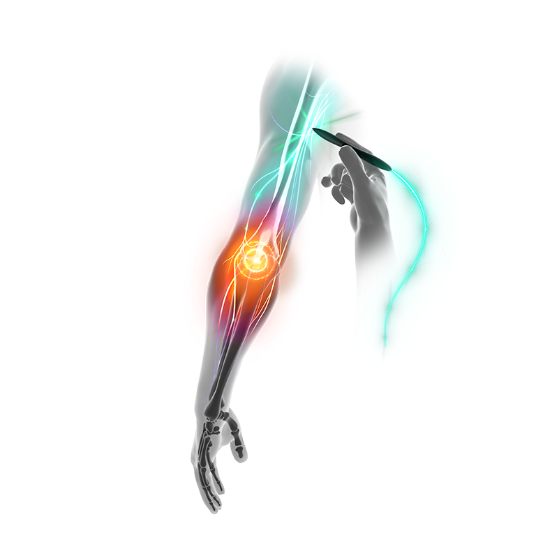 Elbow-Pain