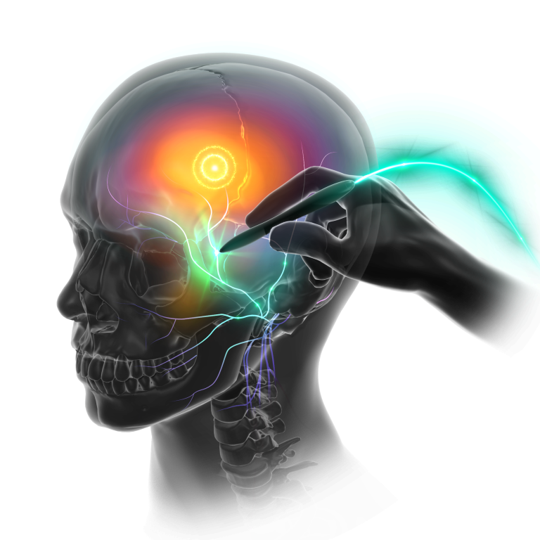 facial-pain