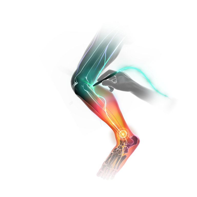 fibular-nerve-pain